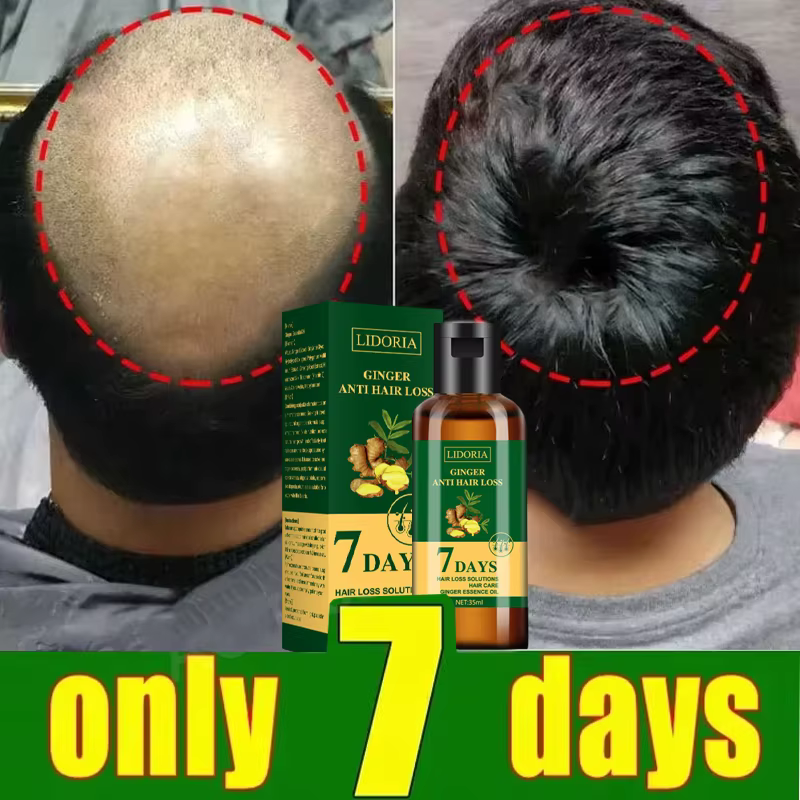 Sérum de croissance des cheveux, capsules essentielles pour une repousse rapide en 7 jours, anti-perte de cheveux, réparation de la calvitie, traitement du cuir chevelu endommagé, pour femmes et homme