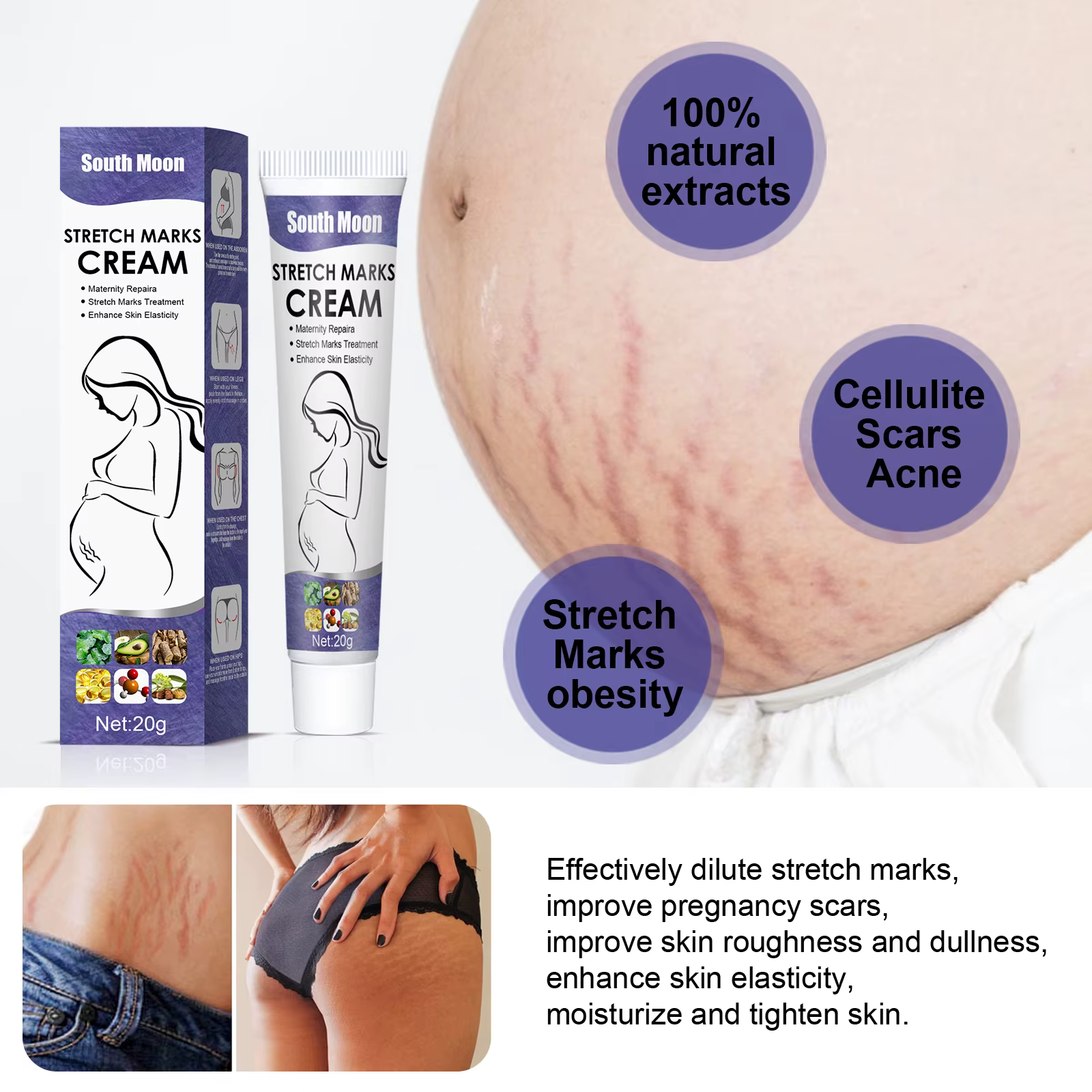 Crème anti-vergetures de grossesse