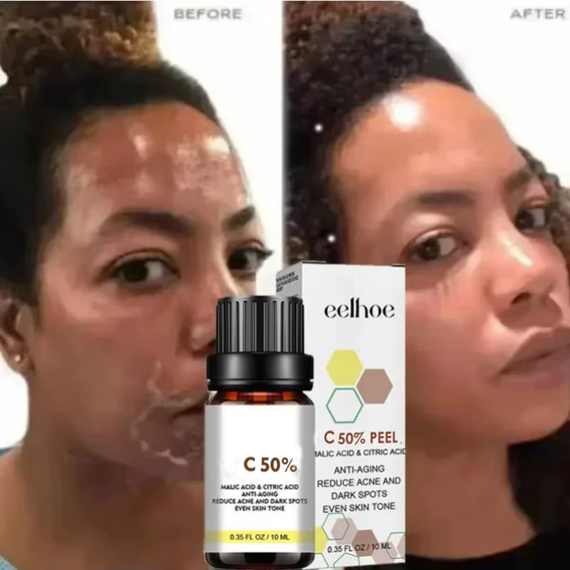 Huile exfoliante pour les taches de peau foncées