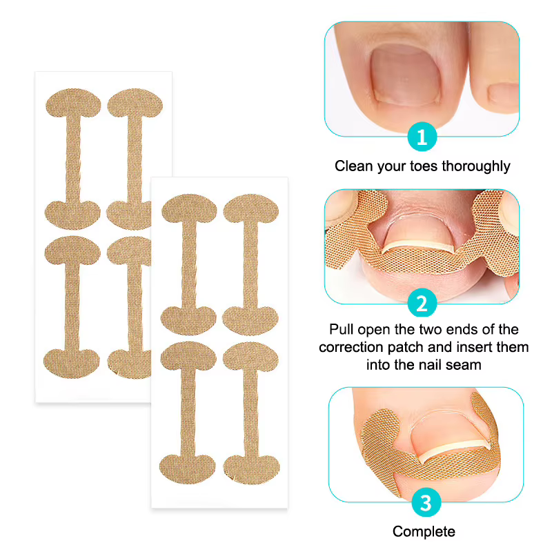 Correcteur professionnel des ongles incarnés – Autocollants de soin des pieds pour la protection
