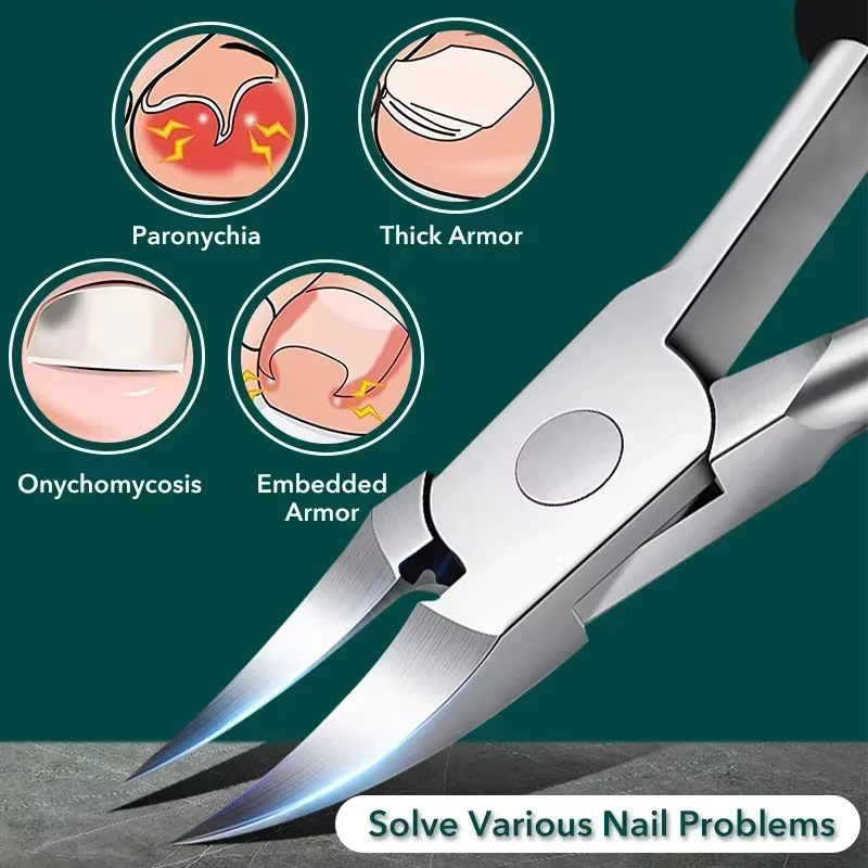 Kit professionnel de correction des ongles incarnés – Coupe-ongles de qualité podologique