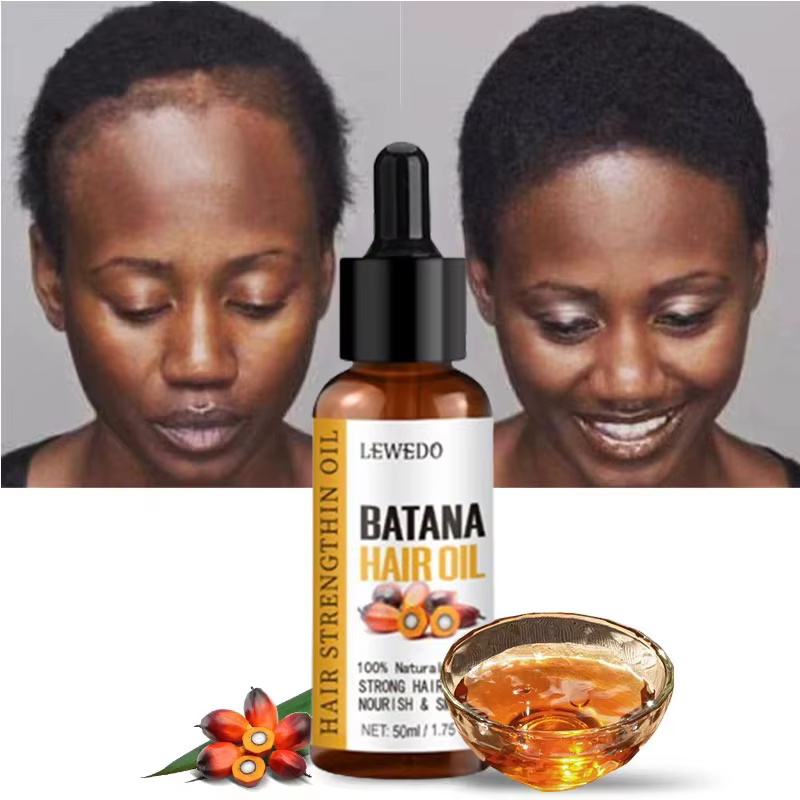 Lewedo Naturals huile de Batana croissance rapide des cheveux pour hommes femmes