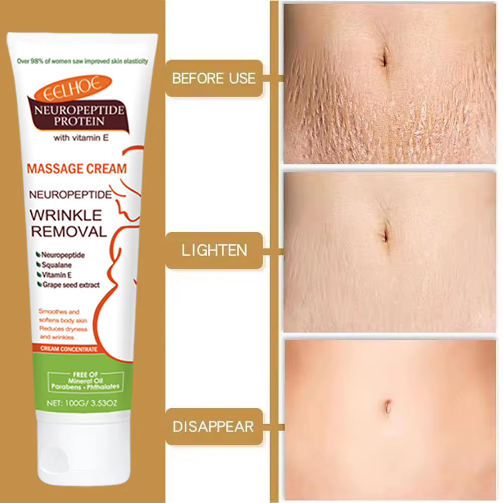 Crème anti-vergetures permanente 100g pour femmes enceintes