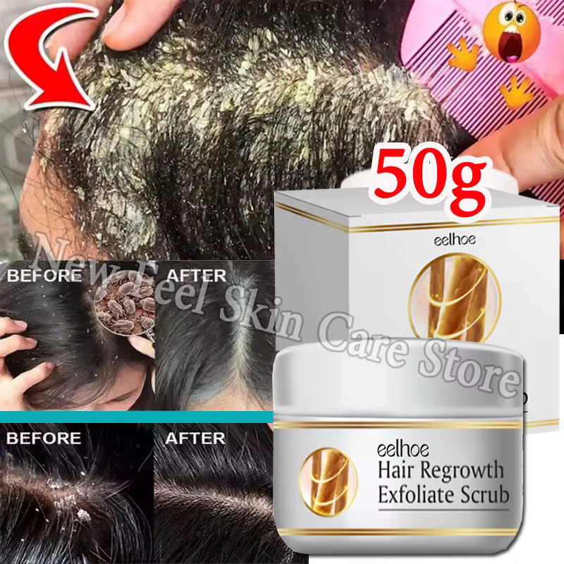 GIslande anti-extinction rapide, élimination des pellicules, traitement anti-démangeaison, cuir chevelu séborrhéique, contrôle de l'huile, réparation du cuir chevelu, beauté, soins de santé