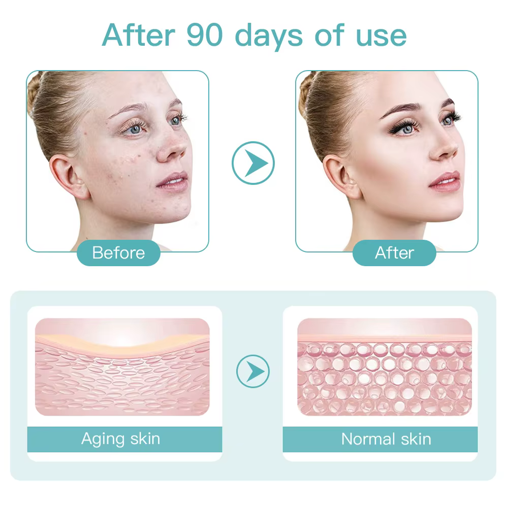 Mini dispositif de beauté du visage à microcourant HIFU EMS