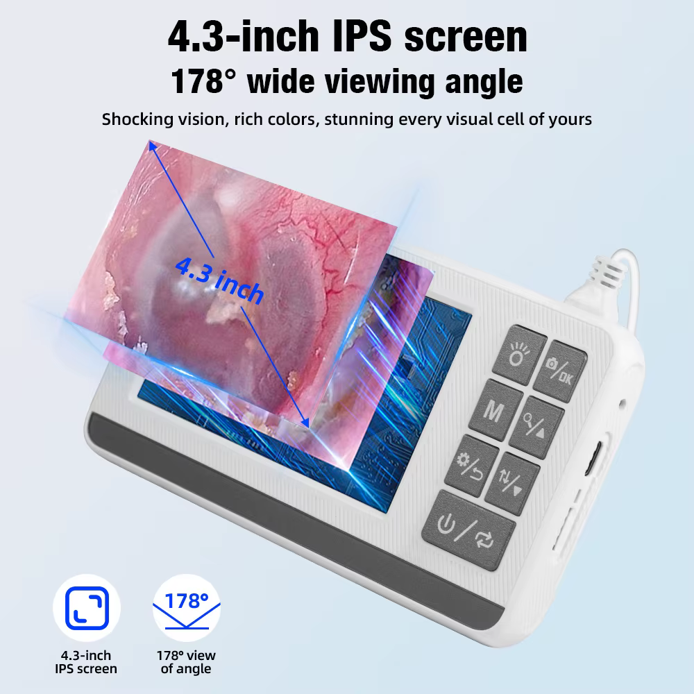 Caméra endoscopique auriculaire, écran LCD 4.3 pouces, Otoscope avec caméra auriculaire légère avec outils d'élimination du cérumen