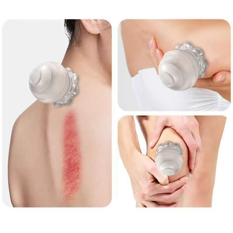 Ventouses de Massage Anti-Cellulite en Silicone