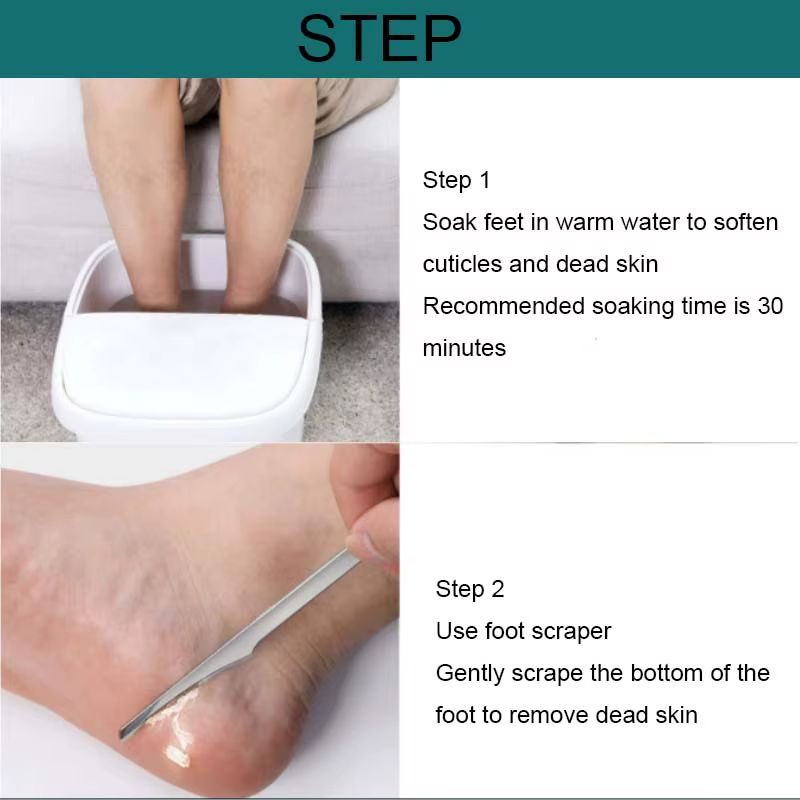 1 pièces manucure pédicure outils orteil ongles rasoir pieds