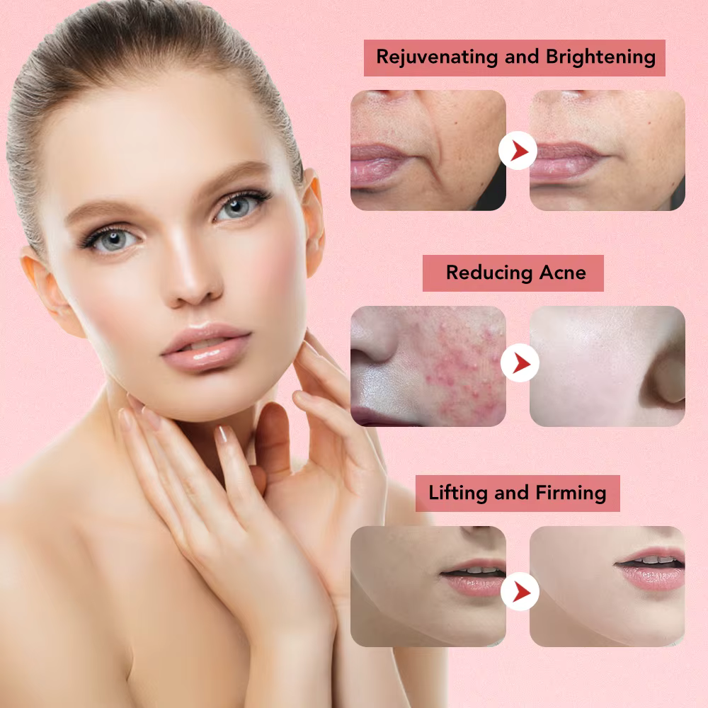 Appareil de Lifting du visage 7 en 1