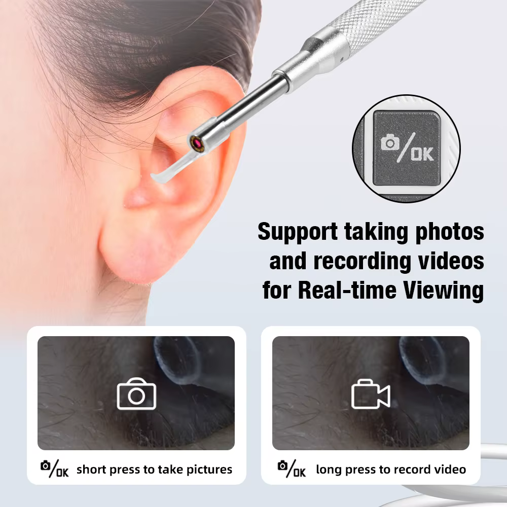 Caméra endoscopique auriculaire, écran LCD 4.3 pouces, Otoscope avec caméra auriculaire légère avec outils d'élimination du cérumen