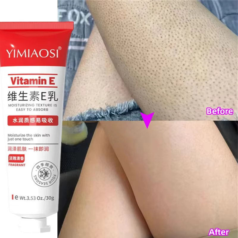 Crème Réparatrice Anti-Graine de Poule