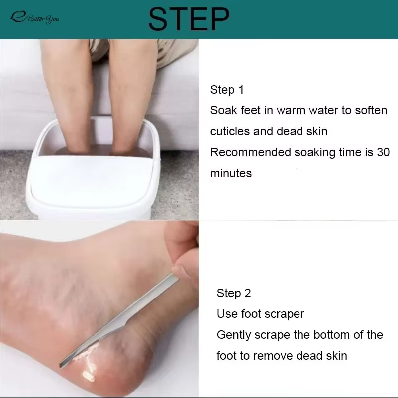 1/3/5 pièces manucure pédicure outil orteil ongles rasoir pieds