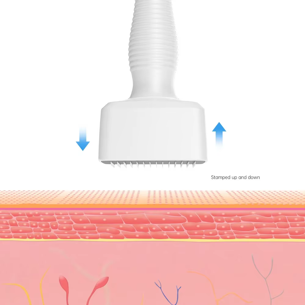 Tampon Derma blanc 140 broches