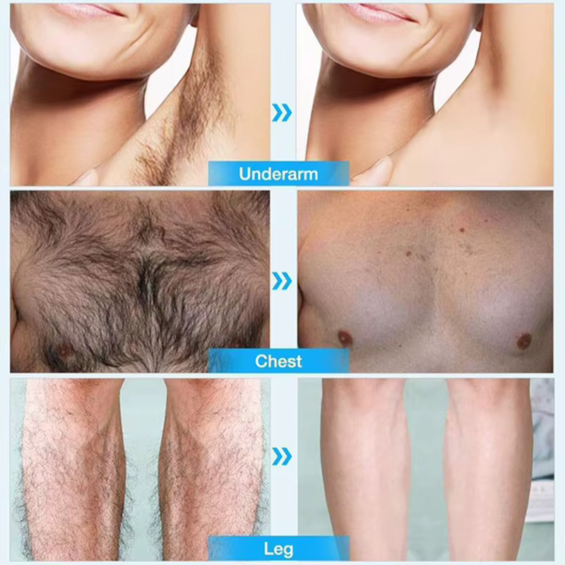 Crème d'épilation permanente indolore parties intimes jambes corps aisselles dépilatoire pour homme femmes blanchissant