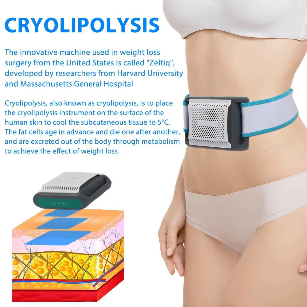 Appareil de cryolipolyse portable