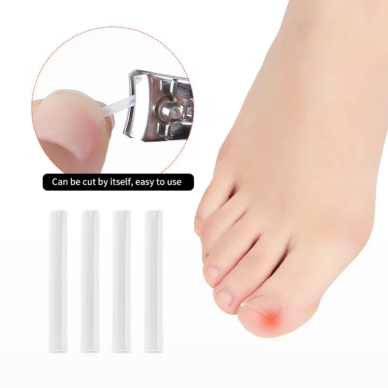 Correction des ongles des pieds