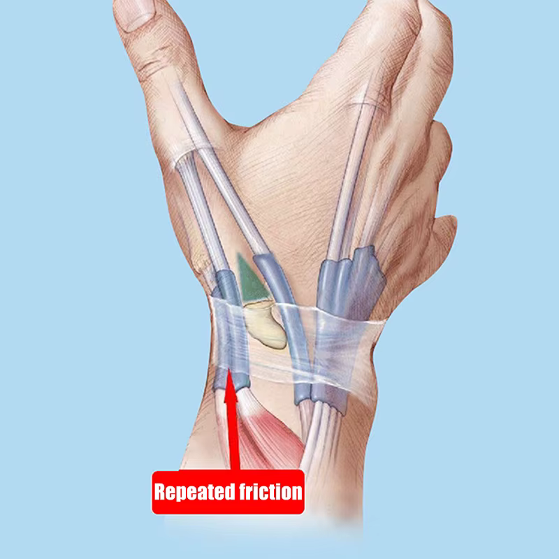 Offre Spéciale. 1 pièce Attelle de pouce et stabilisateur de poignet, Soulagement de la douleur, pour main droite ou gauche, Support de pouce souple, Manchon de compression protecteur