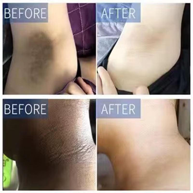 Crème blanchissante pour le corps