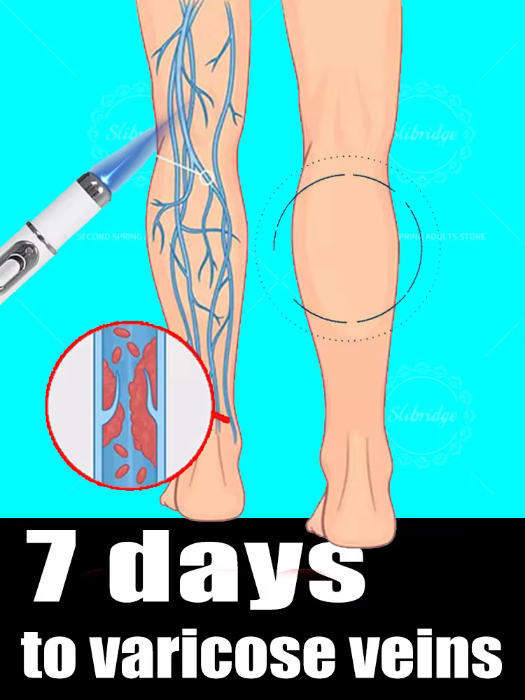 Les outils de soins des jambes éliminent les varices