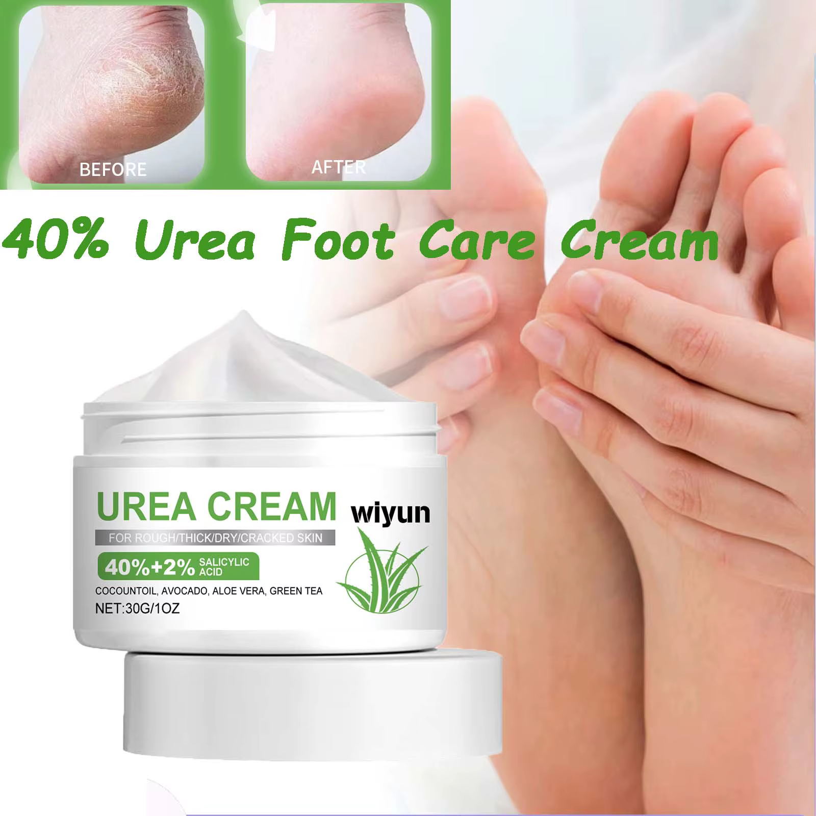 Crème de soin des pieds à l'urée