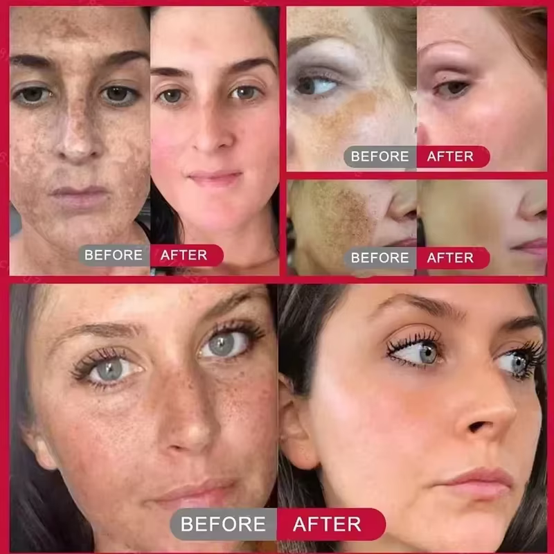 Crème blanchissante pour le visage