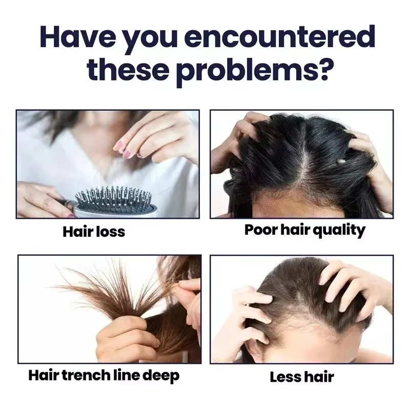La croissance des cheveux, perte essentielle, traitement de repousse, renforce les cheveux, nourrit le cuir chevelu, léger, Non gras, améliore la Circulation du cuir chevelu