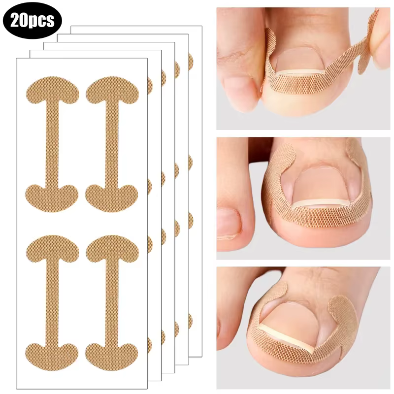 Patch adhésif pour ongles incarnés (5/10/20/30 feuilles) – Autocollant correcteur d'ongles