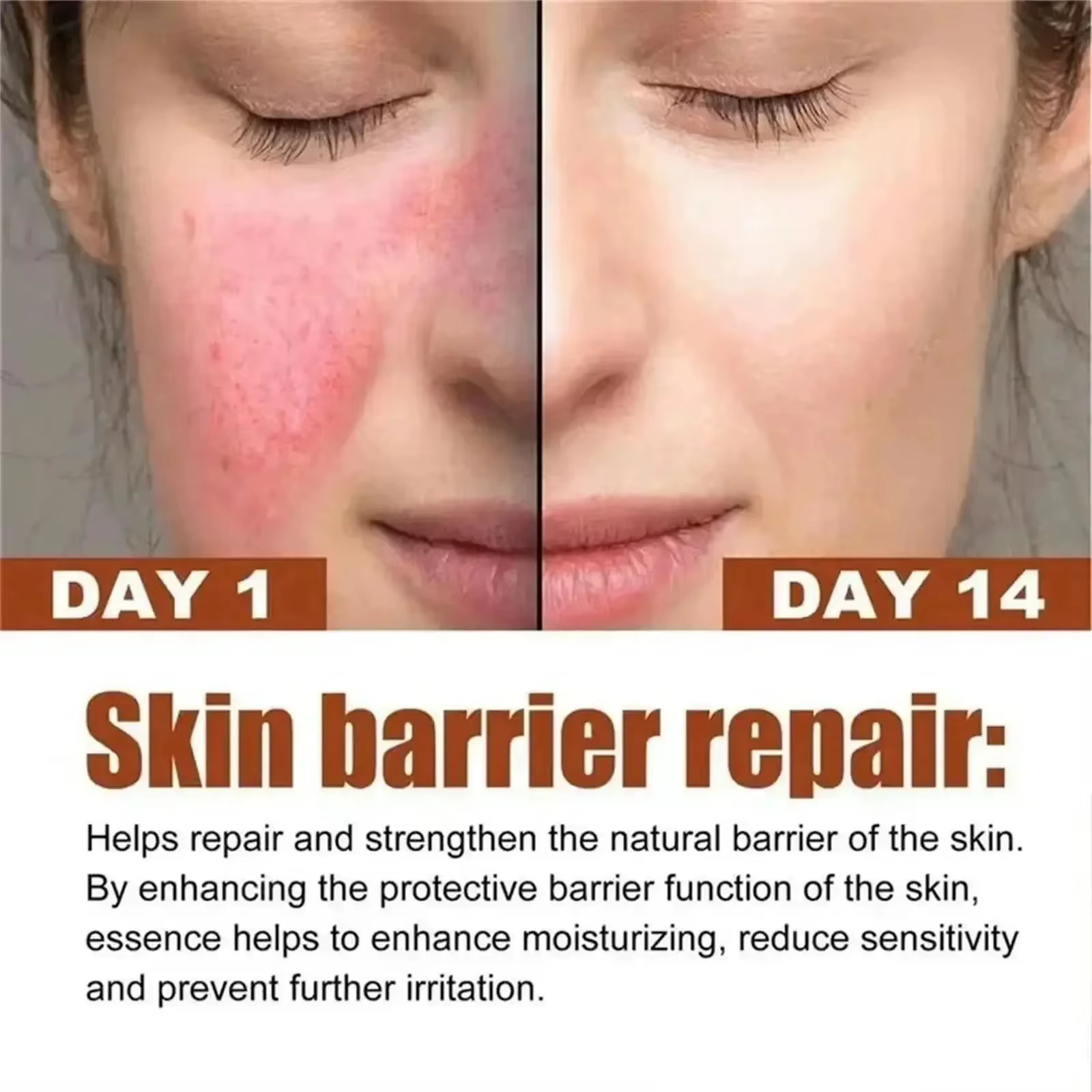Crème réparatrice pour les rougeurs du visage